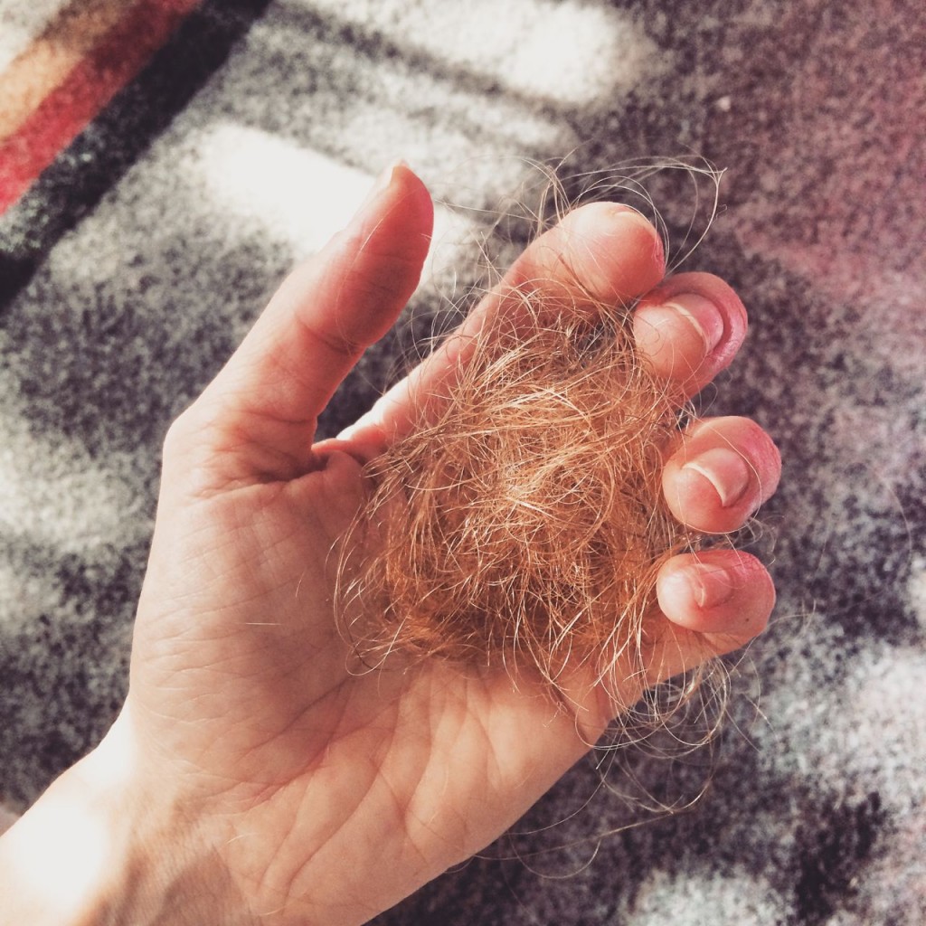pregnancy hair loss