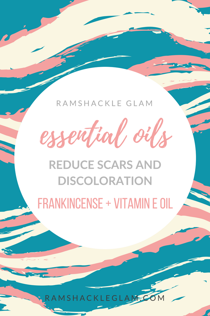 frankincense and vitamin e oil to reduce scars and discoloration