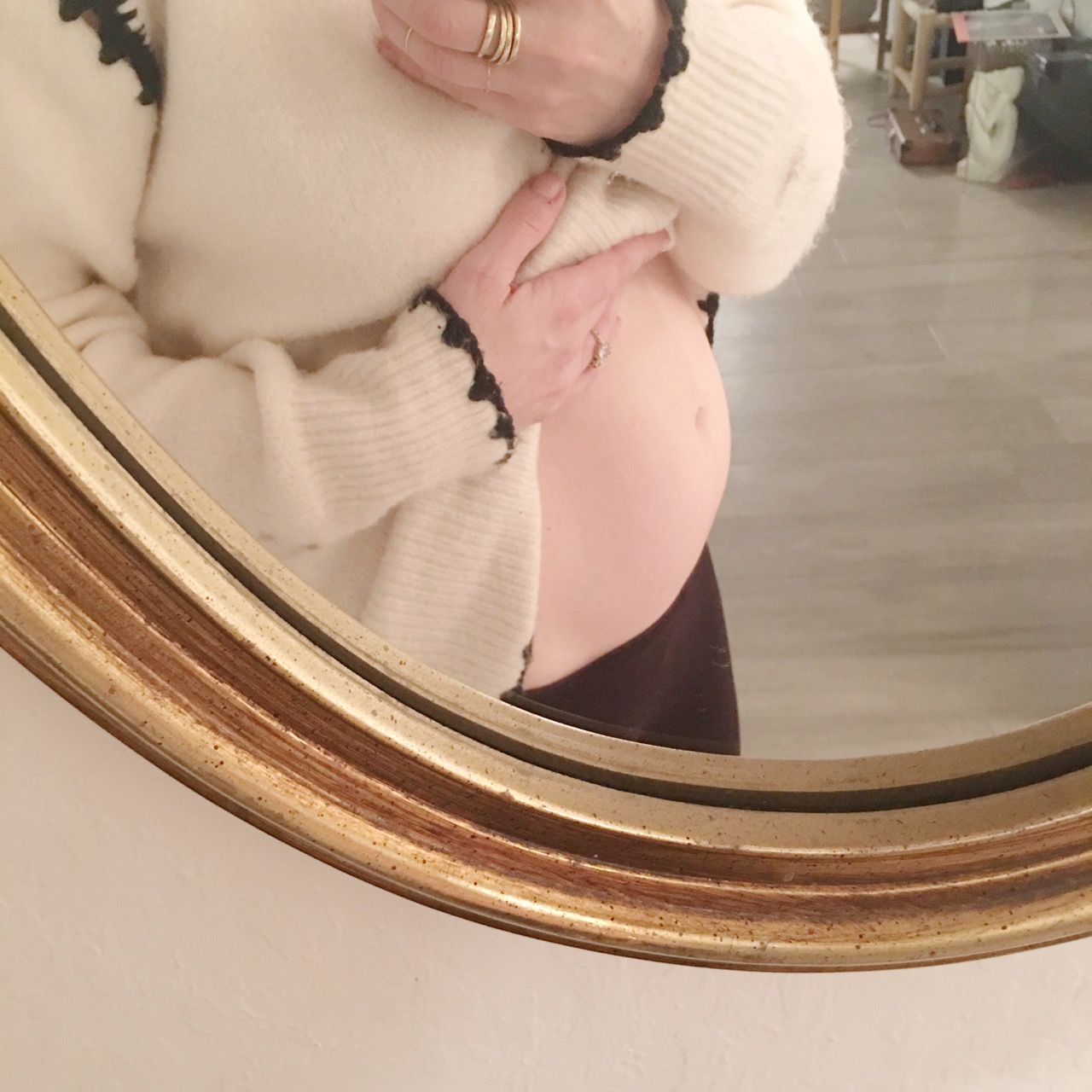 I had a misdiagnosed ectopic pregnancy and lost my Fallopian tube
