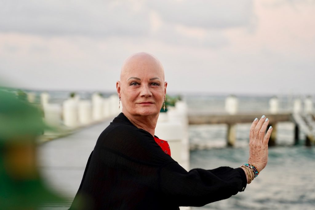 sudden onset alopecia